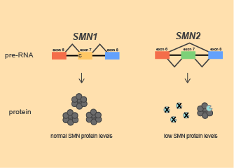 AAV治療脊髓性肌萎縮（SMA）